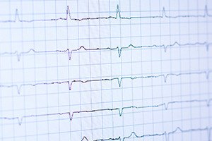ekg dr andrea unger ekg dr andrea unger - ekg_dr_andrea_unger.jpg